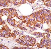 E-cadherin Antibody in Immunohistochemistry (Paraffin) (IHC (P))