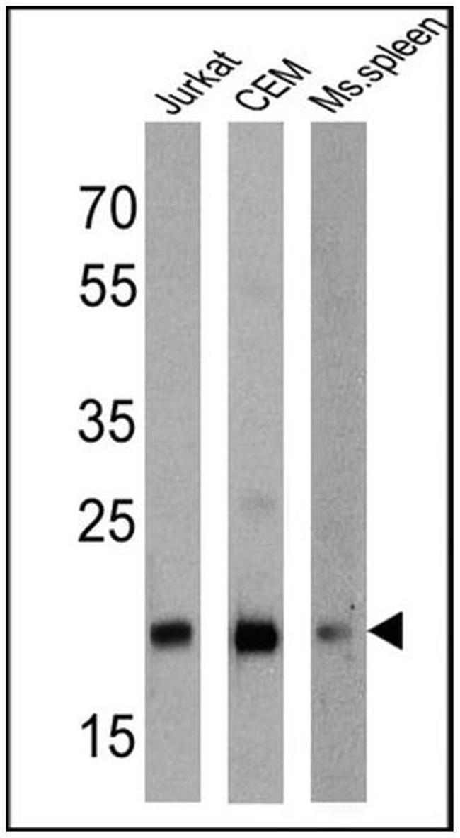 CD3e Antibody in Western Blot (WB)