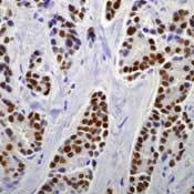 Estrogen Receptor alpha Antibody in Immunohistochemistry (Paraffin) (IHC (P))