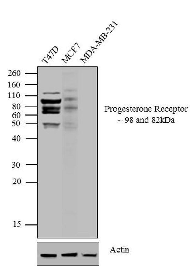 Progesterone Receptor Antibody