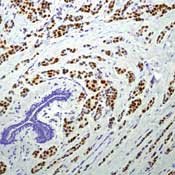 Progesterone Receptor Antibody in Immunohistochemistry (Paraffin) (IHC (P))