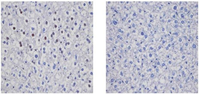 Cyclin D1 Antibody in Immunohistochemistry (Paraffin) (IHC (P))