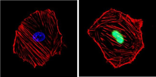 Cyclin D1 Antibody in Immunocytochemistry (ICC/IF)