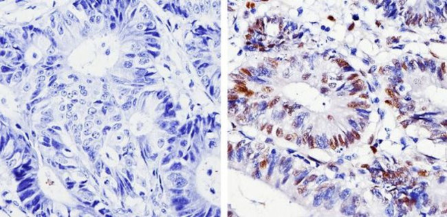 Cyclin D1 Antibody in Immunohistochemistry (Paraffin) (IHC (P))