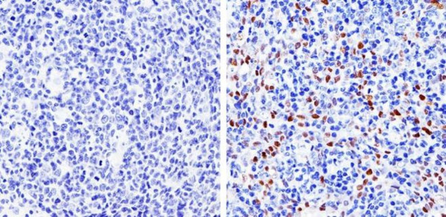 Cyclin D1 Antibody in Immunohistochemistry (Paraffin) (IHC (P))