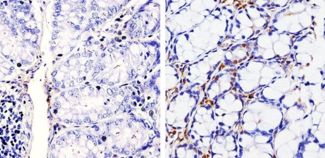 Cyclin D1 Antibody in Immunohistochemistry (Paraffin) (IHC (P))