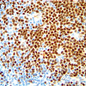 Cyclin D1 Antibody in Immunohistochemistry (Paraffin) (IHC (P))