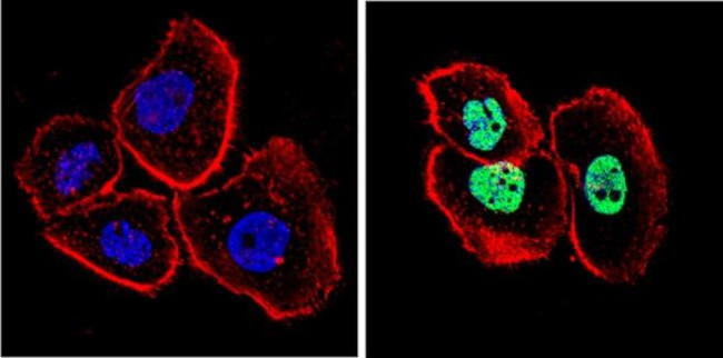 p53 Antibody in Immunocytochemistry (ICC/IF)