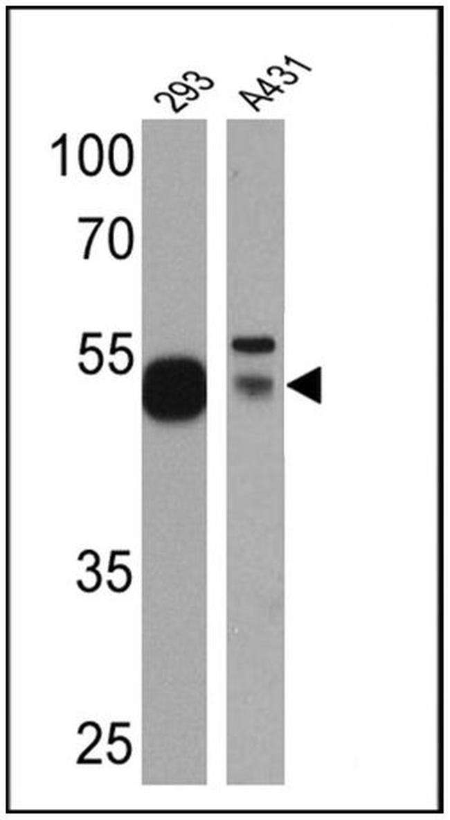 p53 Antibody in Western Blot (WB)