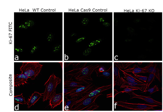 Ki-67 Antibody