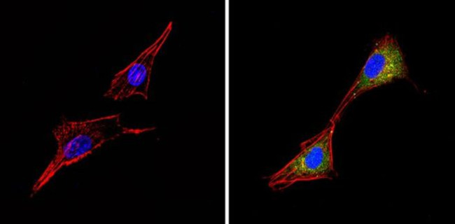 ALK Antibody in Immunocytochemistry (ICC/IF)