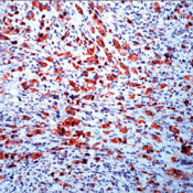 ALK Antibody in Immunohistochemistry (Paraffin) (IHC (P))