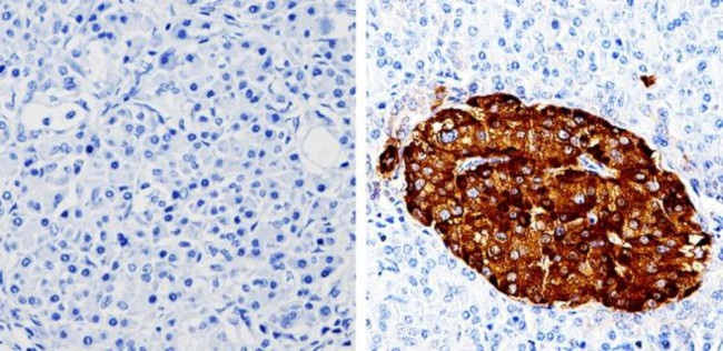 Chromogranin A Antibody in Immunohistochemistry (Paraffin) (IHC (P))