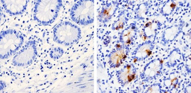 Chromogranin A Antibody in Immunohistochemistry (Paraffin) (IHC (P))