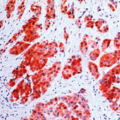 Calretinin Antibody in Immunohistochemistry (Paraffin) (IHC (P))