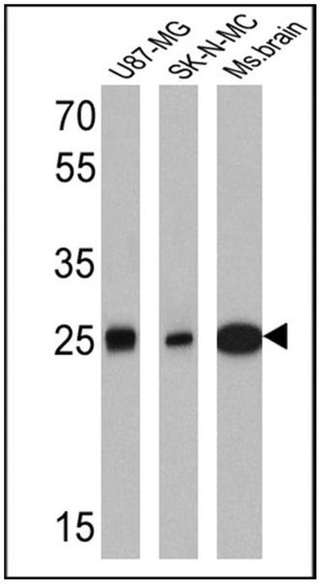 Calretinin Antibody in Western Blot (WB)