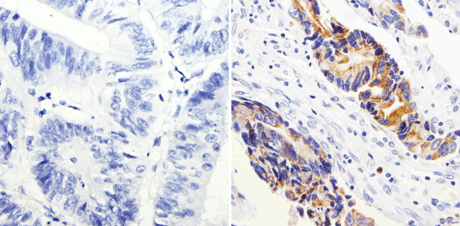 COX2 Antibody in Immunohistochemistry (Paraffin) (IHC (P))