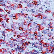 COX2 Antibody in Immunohistochemistry (Paraffin) (IHC (P))