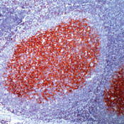 CD23 Antibody in Immunohistochemistry (Paraffin) (IHC (P))