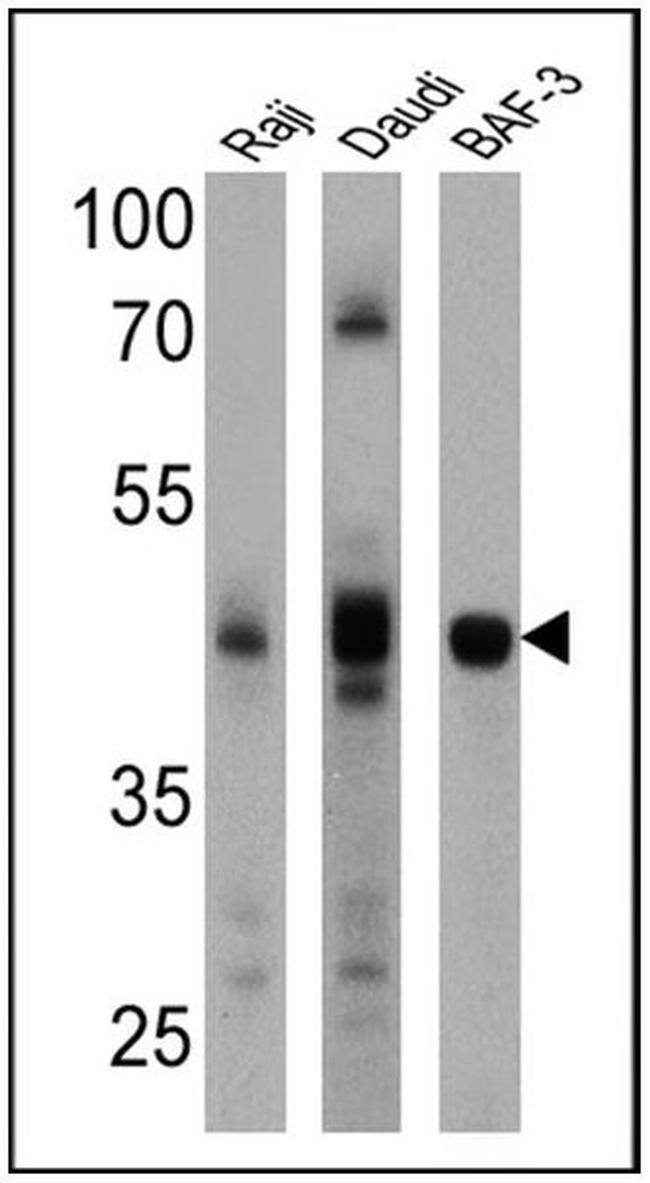 CD23 Antibody in Western Blot (WB)