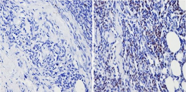 PAX5 Antibody in Immunohistochemistry (Paraffin) (IHC (P))