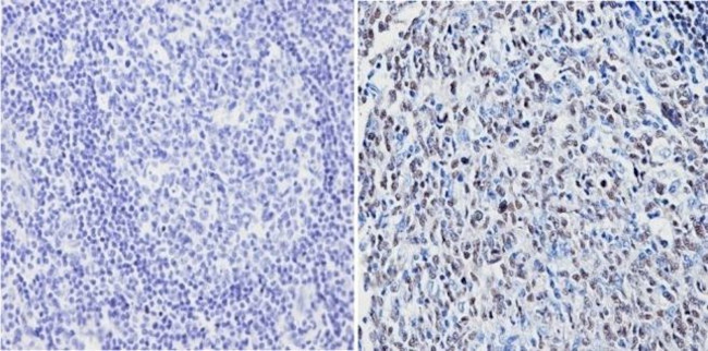 PAX5 Antibody in Immunohistochemistry (Paraffin) (IHC (P))