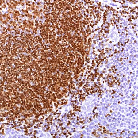 PAX5 Antibody in Immunohistochemistry (Paraffin) (IHC (P))