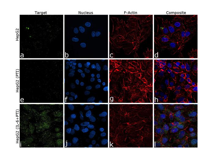 CRP Antibody