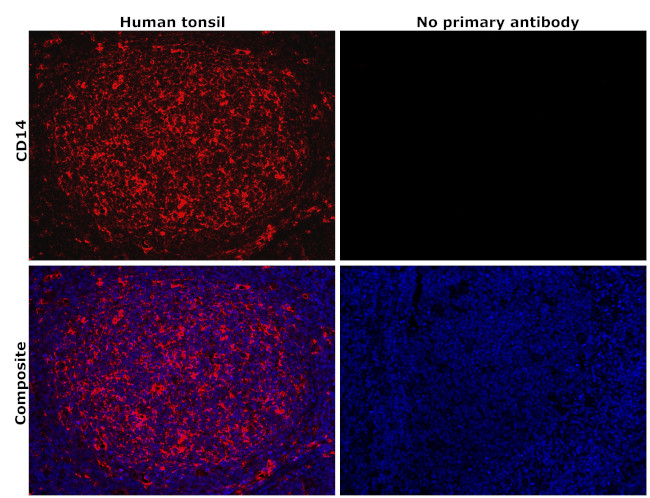 CD14 Antibody in Immunohistochemistry (Paraffin) (IHC (P))