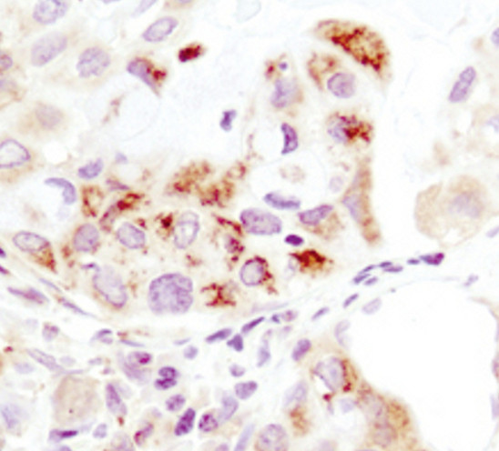 HK1 Antibody in Immunohistochemistry (Paraffin) (IHC (P))