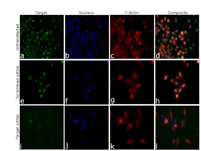 JMJD1B Antibody in Immunocytochemistry (ICC/IF)