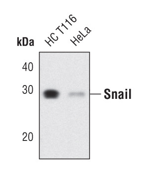 SNAIL Antibody in Western Blot (WB)