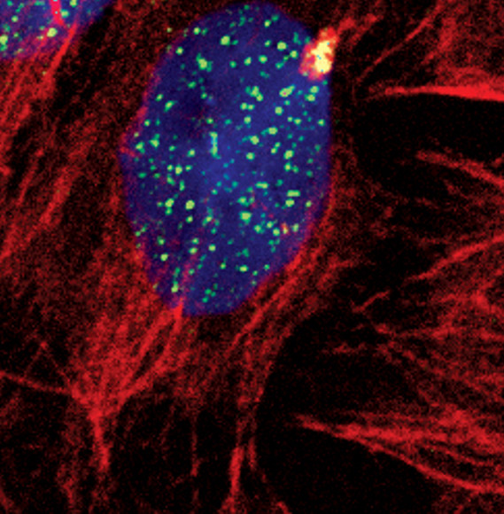 SETD8 Antibody in Immunocytochemistry (ICC/IF)