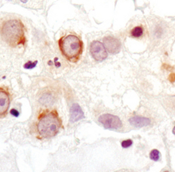 PDHA1 Antibody in Immunohistochemistry (Paraffin) (IHC (P))