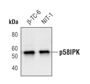 DNAJC3 Antibody in Western Blot (WB)