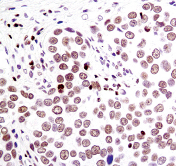 PSIP1 Antibody in Immunohistochemistry (Paraffin) (IHC (P))