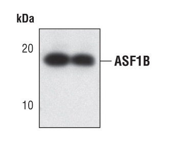 ASF1B Antibody in Western Blot (WB)