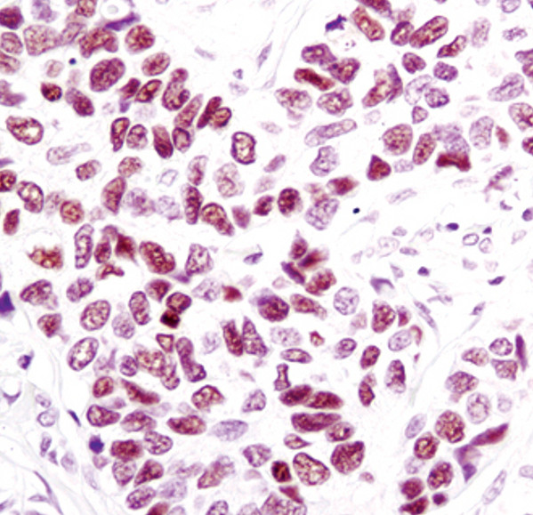 Progesterone Receptor Antibody in Immunohistochemistry (Paraffin) (IHC (P))