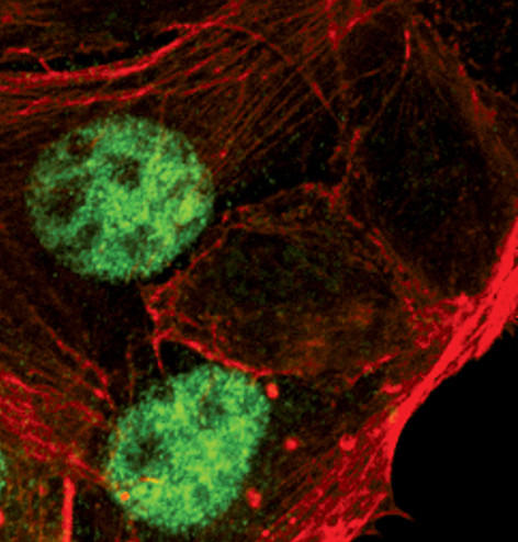 Progesterone Receptor Antibody in Immunocytochemistry (ICC/IF)