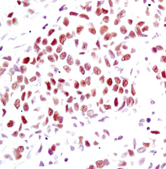 Progesterone Receptor Antibody in Immunohistochemistry (Paraffin) (IHC (P))