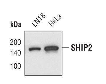 SHIP2 Antibody in Western Blot (WB)