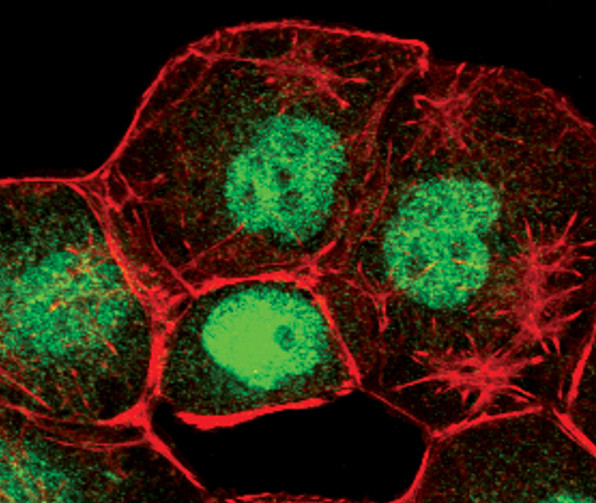 FOXO1 Antibody in Immunocytochemistry (ICC/IF)