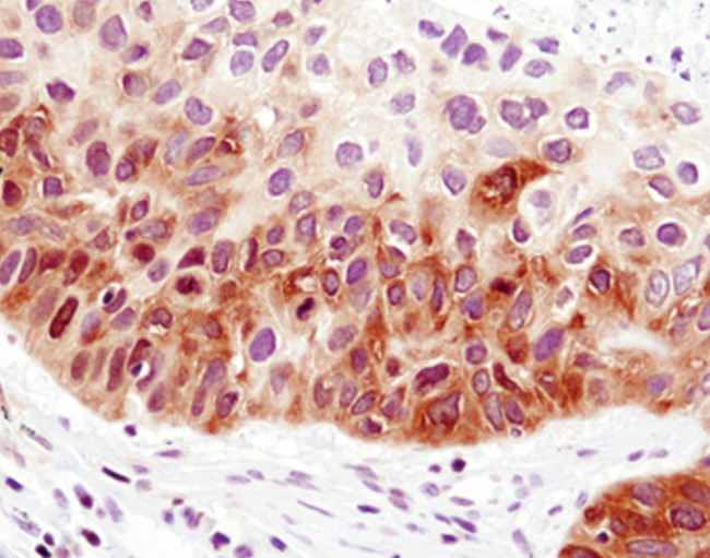 FOXO1 Antibody in Immunohistochemistry (Paraffin) (IHC (P))