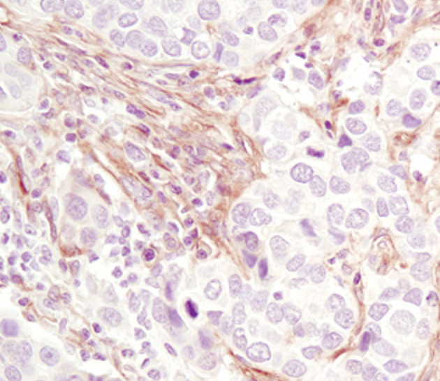 PDGFRB Antibody in Immunohistochemistry (Paraffin) (IHC (P))