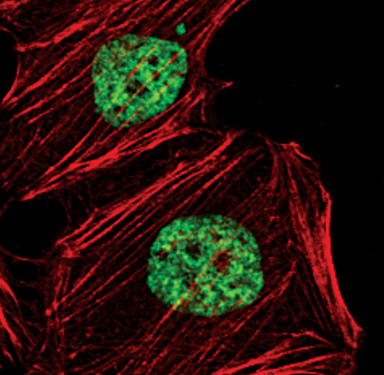 H3K36me2 Antibody in Immunocytochemistry (ICC/IF)