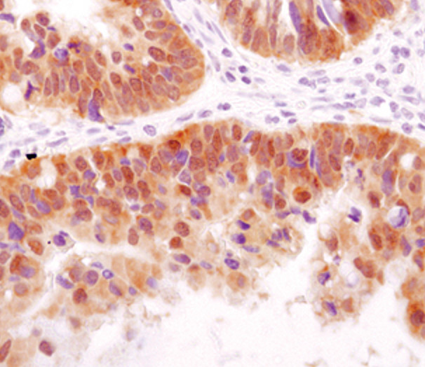 HSP40 Antibody in Immunohistochemistry (Paraffin) (IHC (P))