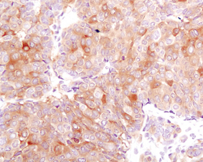 FASN Antibody in Immunohistochemistry (Paraffin) (IHC (P))