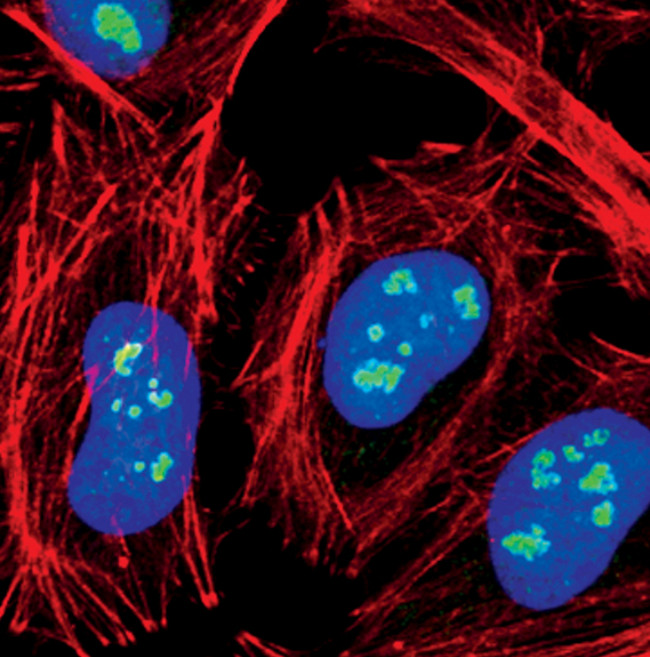 Fibrillarin Antibody in Immunocytochemistry (ICC/IF)