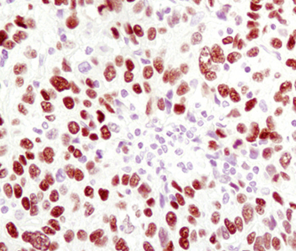 HNF4A Antibody in Immunohistochemistry (Paraffin) (IHC (P))