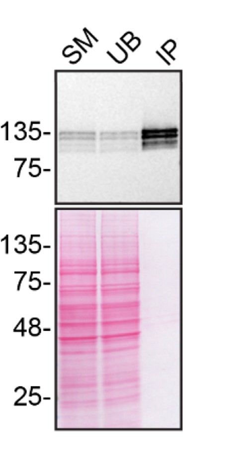 SHIP1 Antibody in Immunoprecipitation (IP)